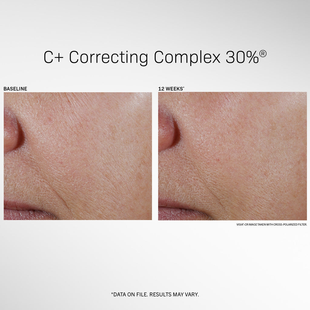 Revision® C+ Correcting Complex 30%® (travel size) -.5 fl oz.